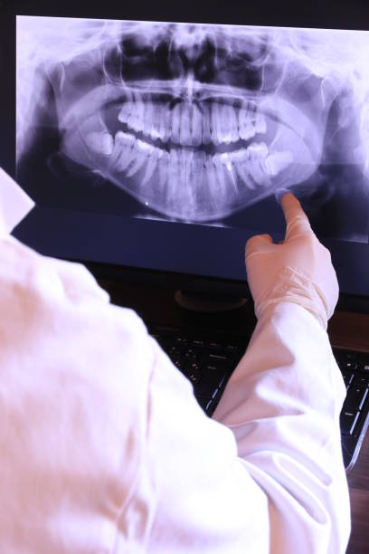 Best Emergency Treatment for Dental Infections or Abscesses in Poinciana, FL